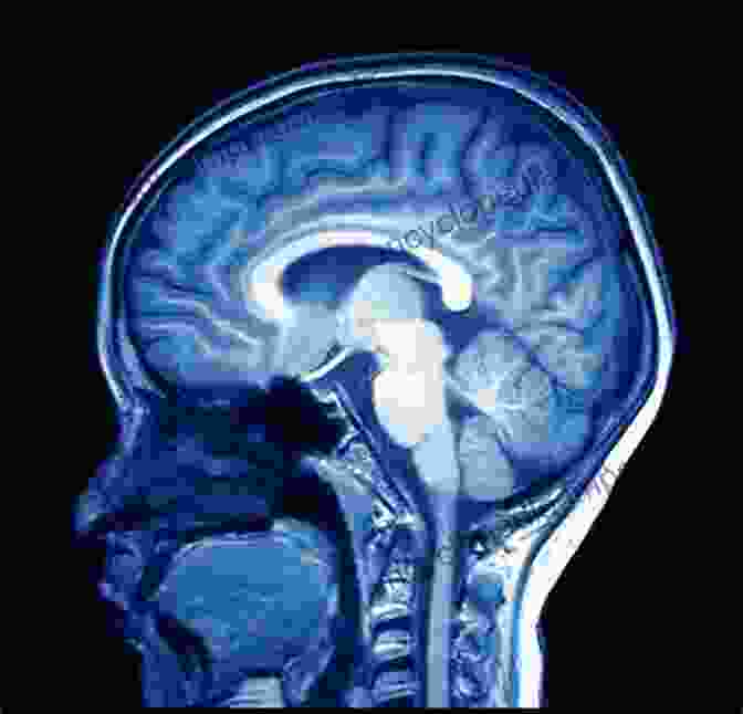 A Detailed MRI Scan Of The Human Brain, Showcasing Its Intricate Structures And Connections. Radiology Case Review Series: Brain Imaging