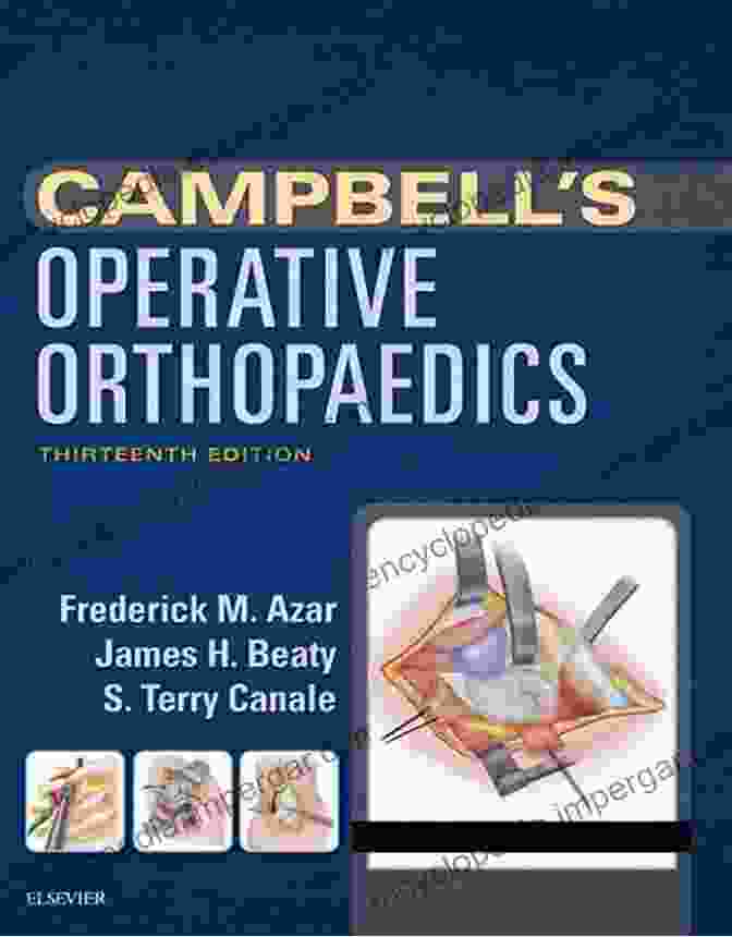 Campbell Operative Orthopaedics, 13th Edition By Terry Canale, MD Campbell S Operative Orthopaedics E S Terry Canale