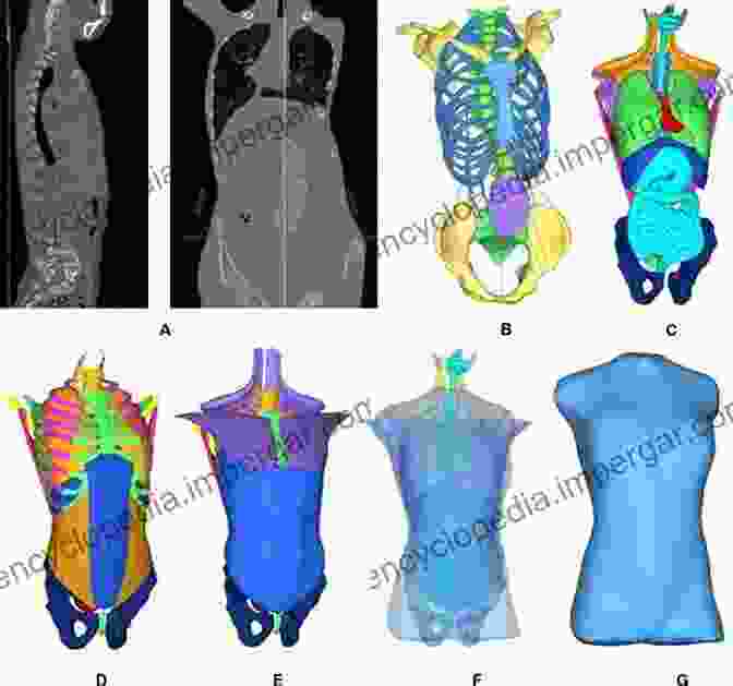 Finite Element Analysis Of Soft Tissue Soft Tissue Biomechanical Modeling For Computer Assisted Surgery (Studies In Mechanobiology Tissue Engineering And Biomaterials 11)