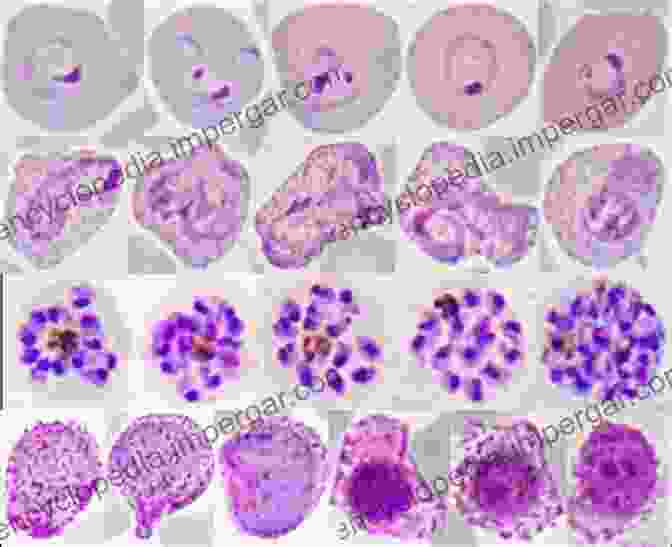 Microscopic Image Of Malaria Parasites Infecting Red Blood Cells Malaria: Immune Response To Infection And Vaccination