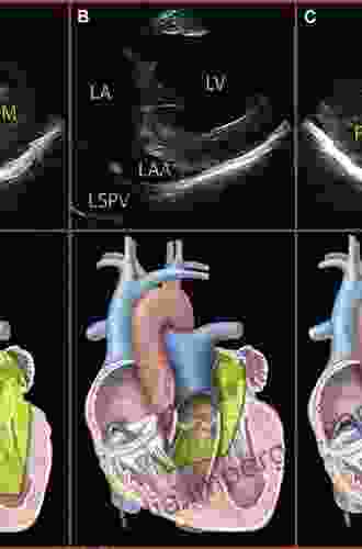 3D Echocardiography of Structural Heart Disease: An Imaging Atlas