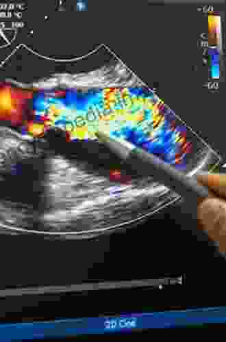 Doppler Echocardiography In Infancy And Childhood