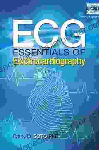 ECG: Essentials Of Electrocardiography