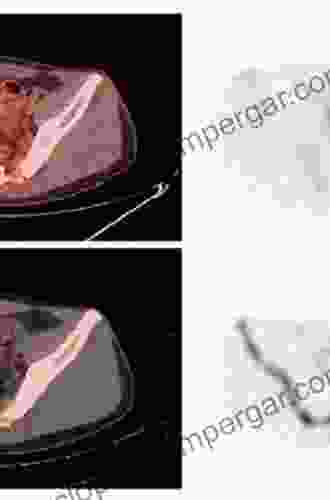 Functional Imaging In Oncology: Clinical Applications Volume 2