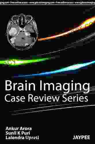 Radiology Case Review Series: Brain Imaging