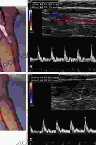 Ultrasonography Of The Upper Extremity: Elbow